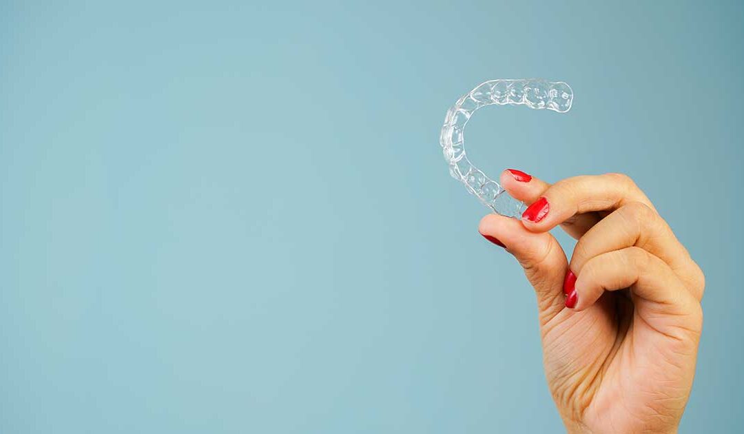 Aligners - invisible braces