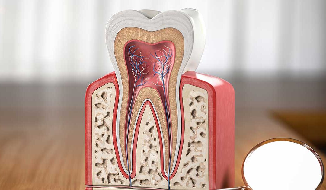 Root canal treatment