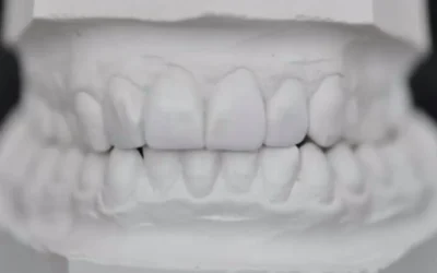 Bruxism: att gnissla tänder